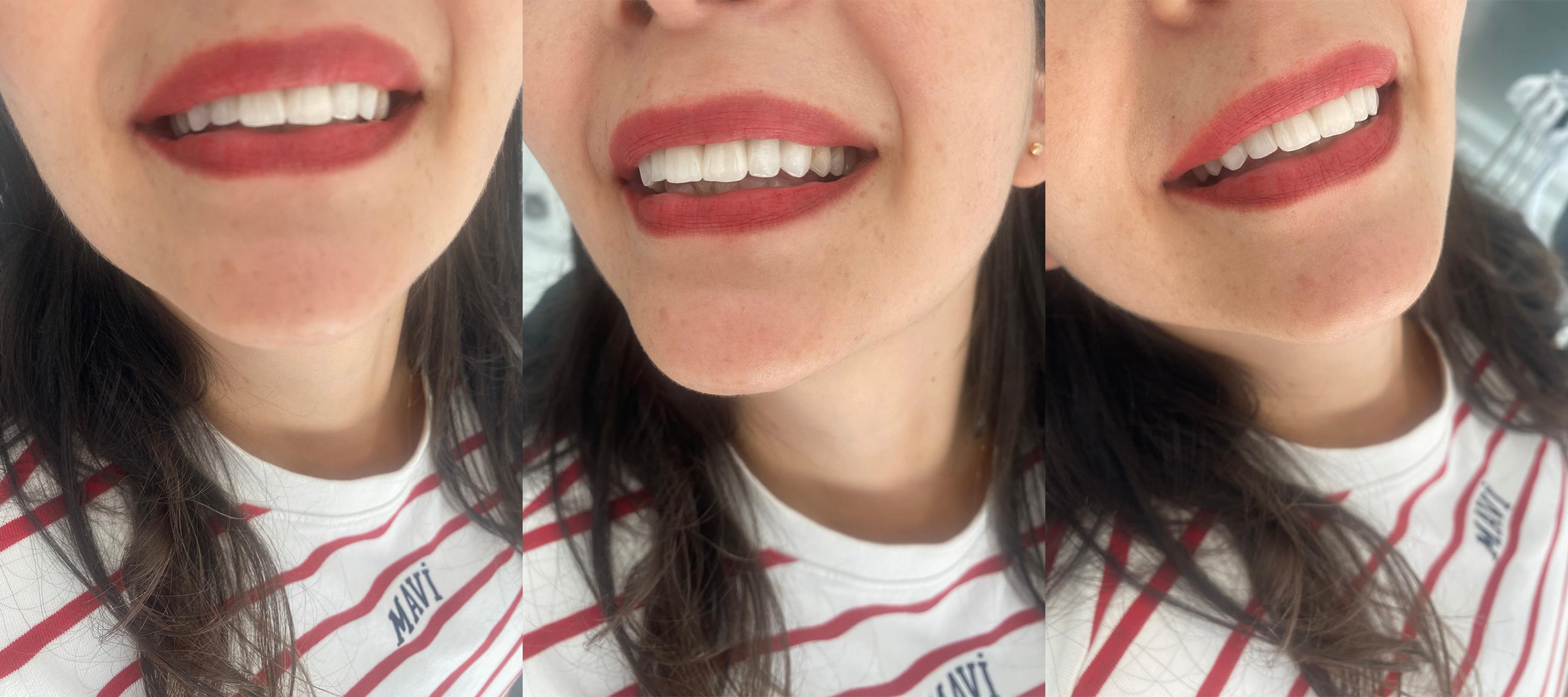 https://beytepedishekimi.com.tr/wp-content/uploads/2025/07/0-1.jpg