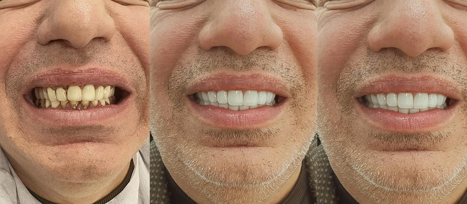 https://beytepedishekimi.com.tr/wp-content/uploads/2025/07/3-1.jpg
